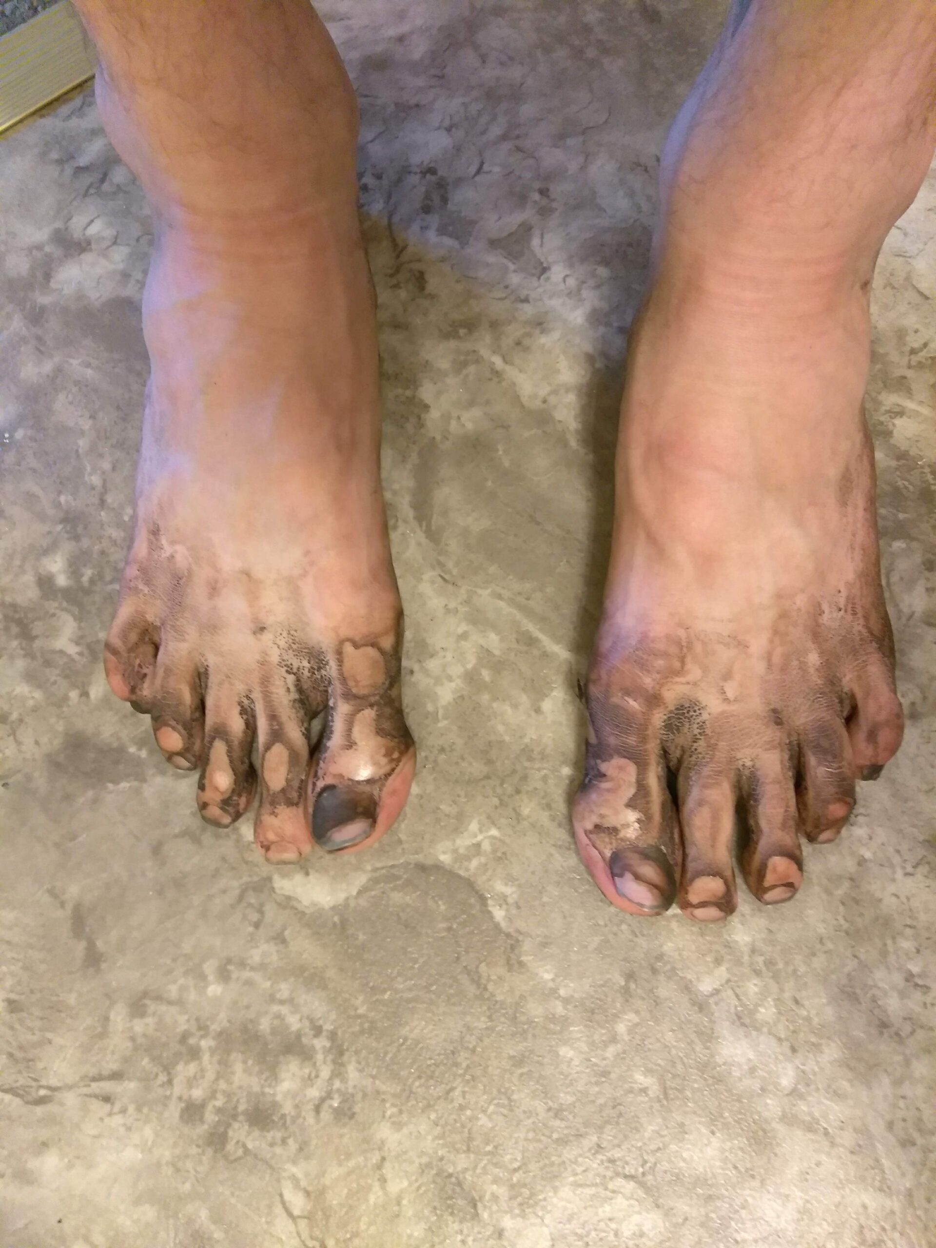 A man's dirty feet after hiking